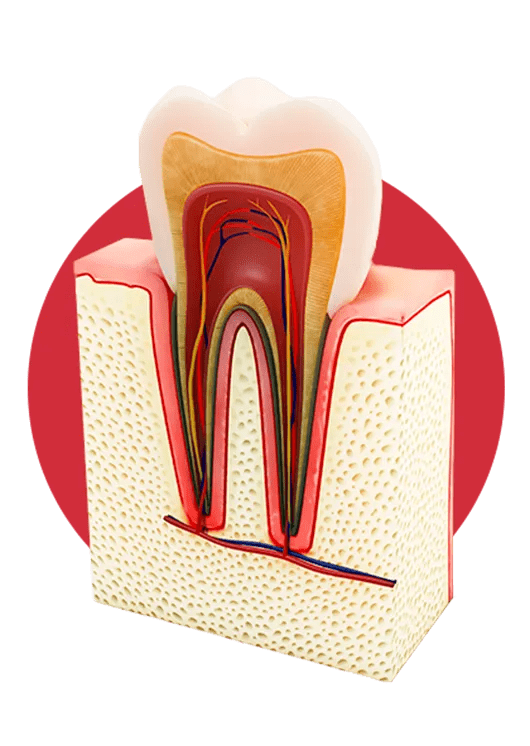 Root canal treatment in Pasadena