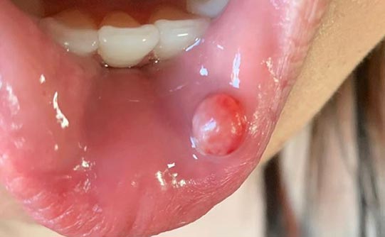 before dental cases in simi valley