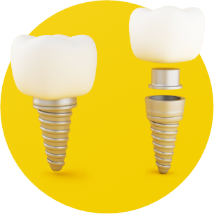 Dental Implant Pasadena Genesis Dental Esthetics