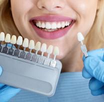 Transform Your Smile with Porcelain Veneers in Pasadena
