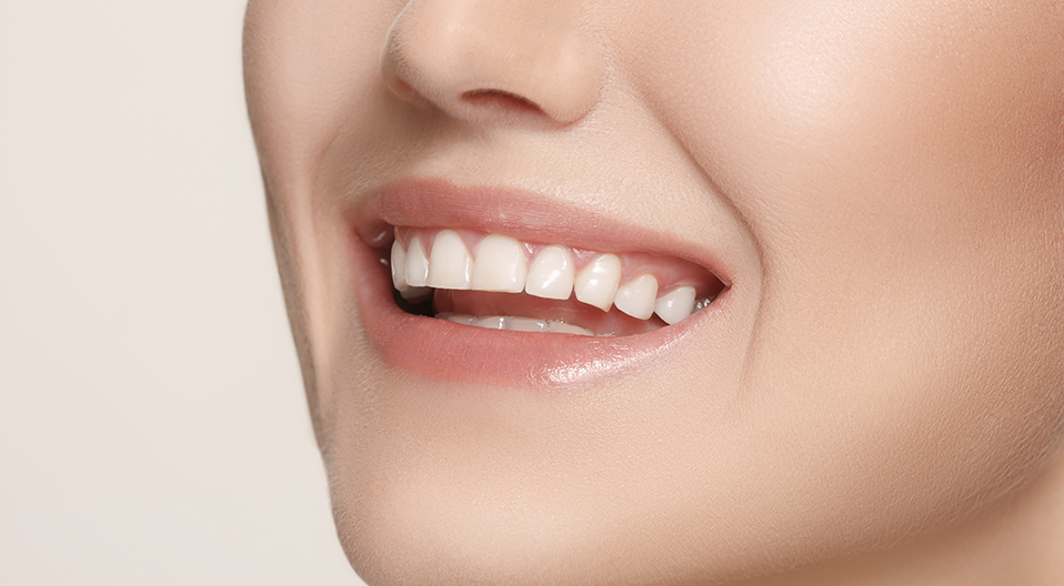 How Can I Get Rid Of Yellow Teeth At Home 