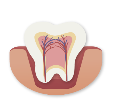 Root Canal case pasadena