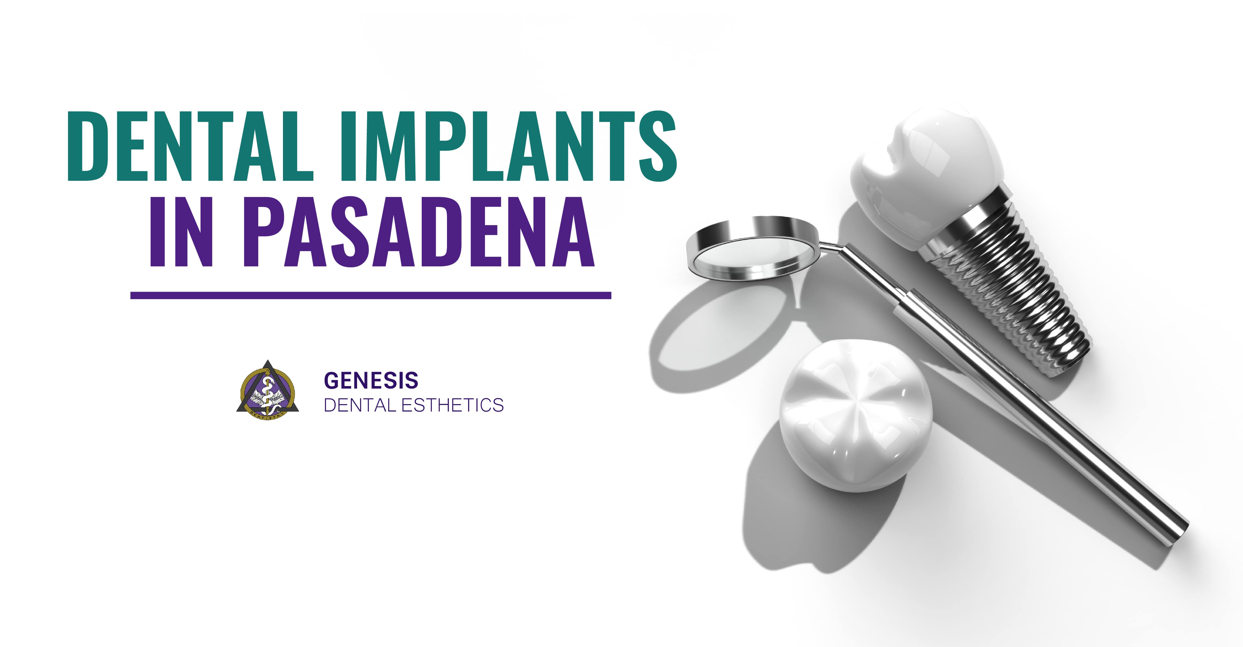 Dental Implant in Pasadena Implant Specialist